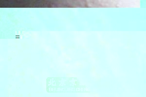 北京治疗皮肤过敏的医院