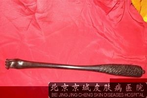 乳房皮肤瘙痒怎么办