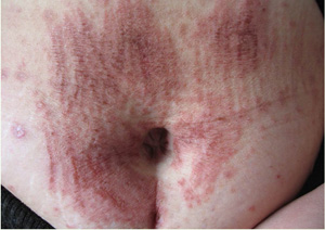 皮肤瘙痒是由什么原因引起的