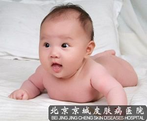 婴儿湿疹的*佳护理