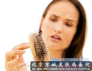 掉头发的原因