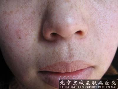 怎么去班要效果好