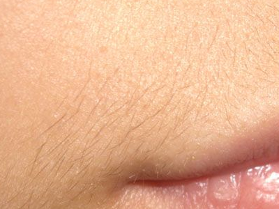 北京激光脱毛哪里好